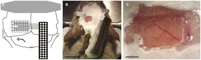 Immunohistological responses in mice implanted with Parylene HT – ITO ECoG devices